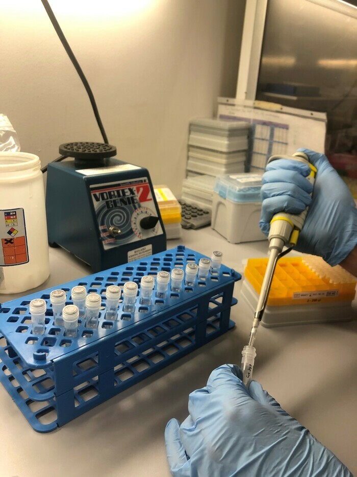 CJBG Mains avec des gants bleus et une pipette de laboratoire