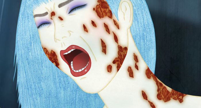 dessin d'uune femme aux cheveux bleu clair qui semble montrer des blessures sur son visages