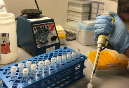Mains avec des gants bleus et une pipette de laboratoire