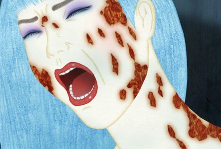 dessin d'uune femme aux cheveux bleu clair qui semble montrer des blessures sur son visages