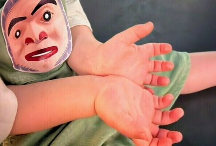 DR AHO MEG Les paumes des mains d'un enfant qui a un autocollant collé sur son habit. cet autocollant représente le masque d'un prince.