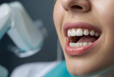 Image par Gerd Altmann de Pixabay Image des dents d'une personne